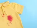 Gelbes Poloshirt mit roten Flecken, die nach dem Entfernen von Kleidung suchen.